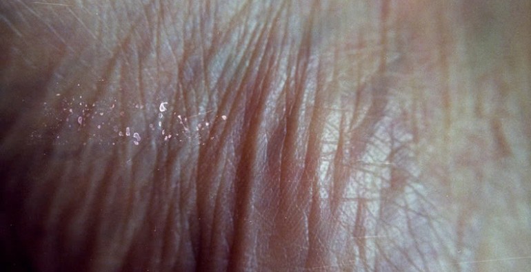IrisErlings_Web1